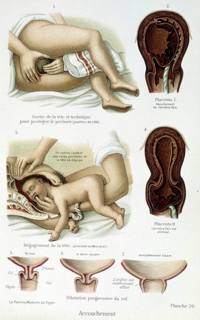Poród - rada naukowa, koniec XIX w. autorstwa Unknown artist