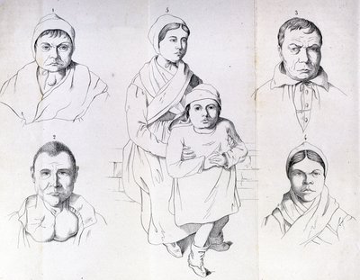 Rozważania nad przyczynami endemicznego kretynizmu Morela. autorstwa Unknown artist