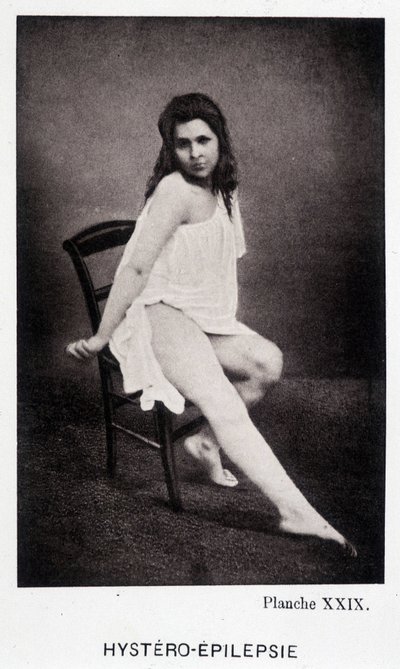 Hystero Epilepsie - Przykurcz w „Ikonografii fotograficznej Salpétrière: służba pana Charcota” autorstwa Paula Regnarda i Bourneville autorstwa Unknown artist