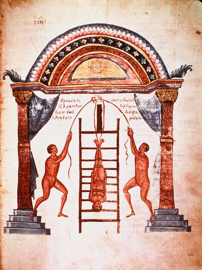 Medycyna: redukcja zwichniętego kręgosłupa, pacjenta wiesza się pasami do drabiny (rękopis) autorstwa Unknown artist