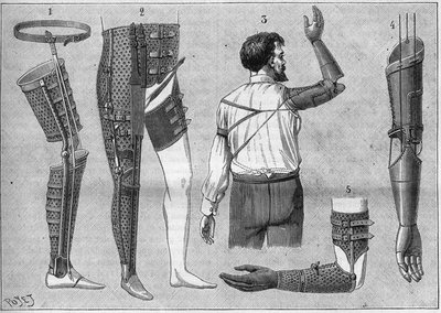Nowoczesna aparatura do amputacji. 1) sztuczna noga z paskiem, 2) aparat do desarticules uda, 3 i 4 sztuczne ramiona wynalezione i zbudowane przez M.L Matthieu dla śp. Rogera, 5) sztuczne ramię z ręką, kciukiem i palcem wskazującym. w „La natura” z 1888 ro autorstwa Unknown artist