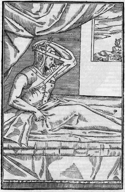 Chirurgia nosa: Chirurgia rekonstrukcyjna nosa w „De curtorum chirurgia per insitionem”. Wenecja autorstwa Unknown artist