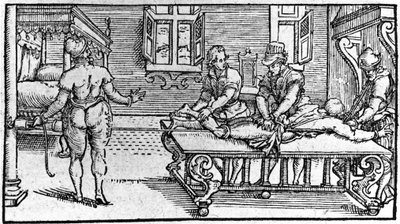 Redukcja zwichnięcia, w „Traktacie medycznym” Ambroise Paré, około 1560 r. autorstwa Unknown artist