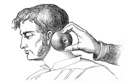Saignee locales - aplikacja pijawek z jabłkiem - grawer w "La Santo Universelle - Medical Guide for Families" 1852 autorstwa Unknown artist