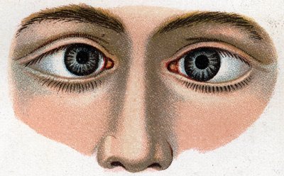 Zez zbiegają się. „Nowy naturalny lek” autorstwa F.E. Bilza. autorstwa Unknown artist