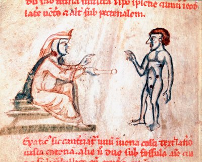 Lekarz przypala pacjenta gorącym żelazkiem w bolące miejsca Miniatura z rękopisu "De Medicina cauteriorum secundum Brunum, Rugerius et Rolthe" XIII-wieczny Paryż, B.N. autorstwa Unknown artist