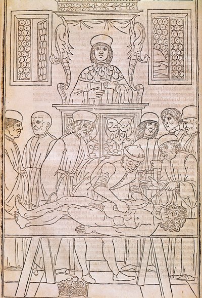 Autopsja. Kodeks. Lekarze rozbiorą ciało martwego mężczyzny w celu zbadania anatomii. „”Fasciculus Medicinae””.Kodeks fascykułu lekarskiego Johannesa Kethana autorstwa Unknown artist