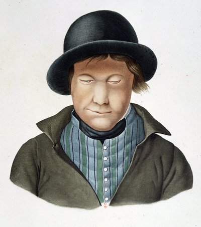 Trędowaci z Islandii, ok. 1840, B.N. autorstwa Unknown artist
