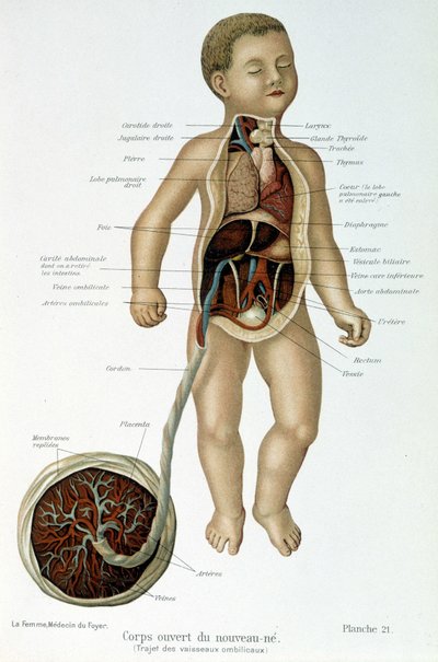 Lekarstwo: noworodek (ze skórą w biuście). autorstwa Unknown artist