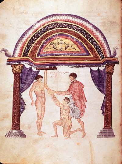 Medycyna: redukcja zwichniętego łokcia, powieszenie pacjenta za ramię (rękopis) autorstwa Unknown artist