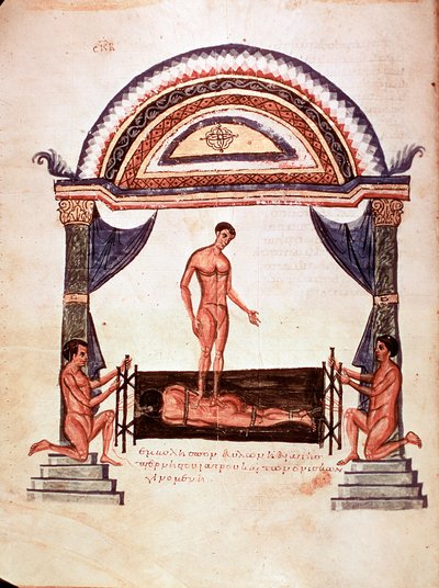 Medycyna: redukcja zwichniętego kręgosłupa - pacjent jest umocowany na drewnianej desce, jeden z terapeutów stoi mu na plecach (rękopis autorstwa Unknown artist