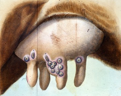 Pierś krowy użyta do zaszczepienia szczepionki przeciwko ospie przez Luigi Sacco (1769-1836) w styczniu 1801 r. Tabliczka medyczna z „”Szczepionka szczepień” Luigi Sacco, Mediolan autorstwa Unknown artist