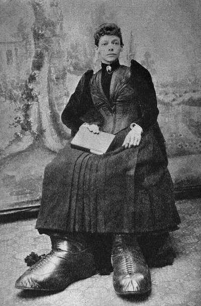 Potwory, Bertha z dużymi stopami. Fotografia, koniec XIX wieku, Paryż. Dz. Selva. autorstwa Unknown photographer