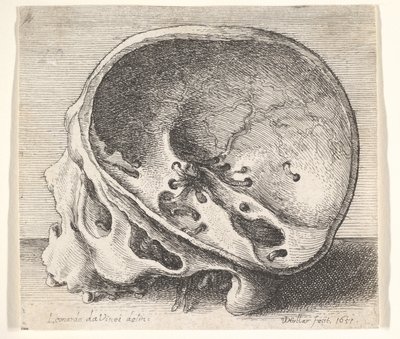 Przekrojona czaszka z profilu w lewo z usuniętą lewą stroną czaszki, 1651. autorstwa Wenceslaus Hollar