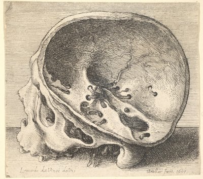 Przekrojona czaszka z profilu w lewo z usuniętą lewą stroną czaszki, 1651. autorstwa Wenceslaus Hollar