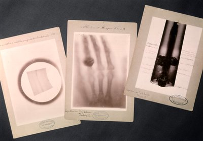 Oryginalne radiogramy Roentgena (radiografia) autorstwa Wilhelm (after) Röntgen