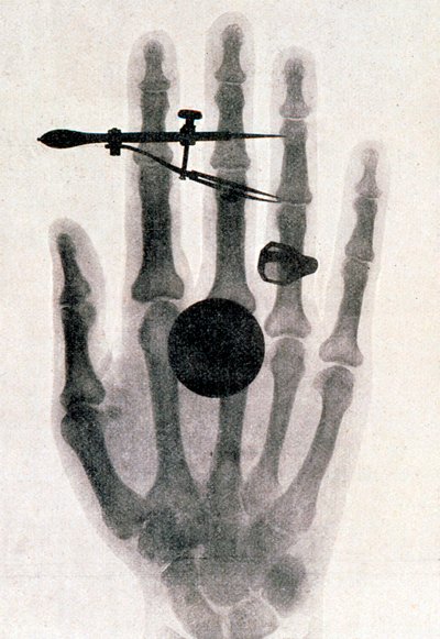 Zdjęcie rentgenowskie ręki żony Wilhelma Roentgena, 1896 autorstwa Wilhelm Conrad Rontgen