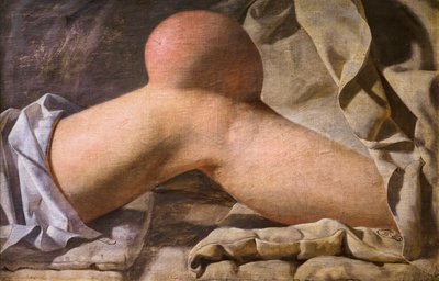 Obrzęk w Regio Patellaris [kolano] autorstwa Wilhelm Ferdinand Bendz