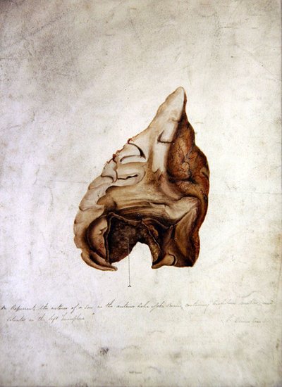 Study of Brain I, ok.1850 (akwarela na papierze) autorstwa William Lover