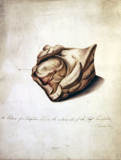 Study of the Brain II, ok.1850 (akwarela na papierze) autorstwa William Lover