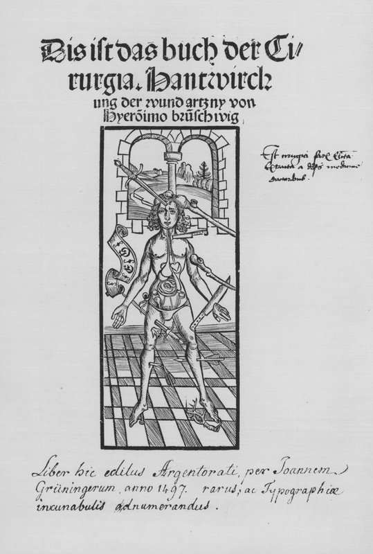 Księga Cirurgii Hieronymusa Brunschwiga (lito) autorstwa (after) German School