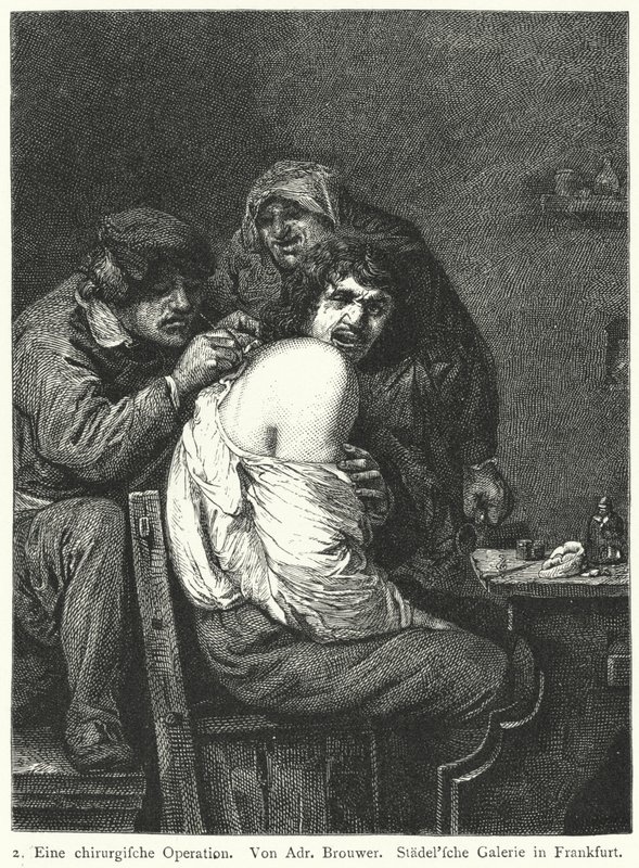 Operacja z tyłu autorstwa Adriaen (after) Brouwer