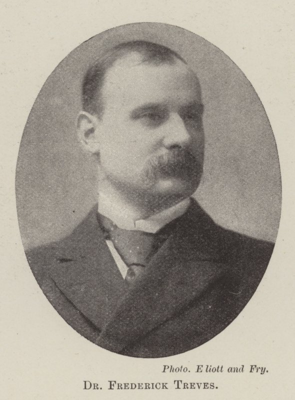 Dr Frederick Treves autorstwa English Photographer
