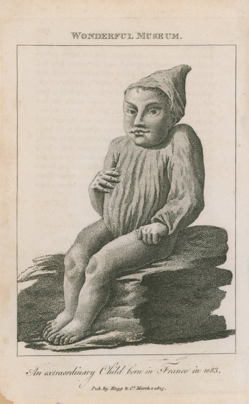 Niezwykłe dziecko urodzone we Francji w 1683 r. autorstwa English School