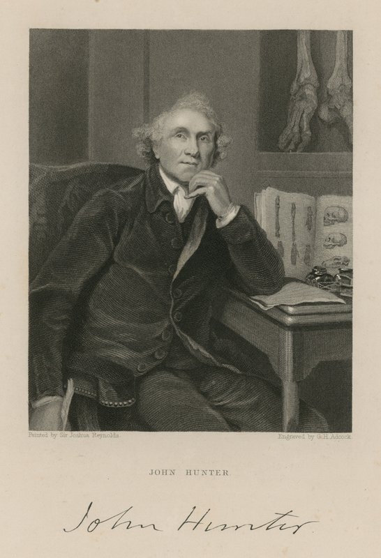John Hunter autorstwa English School