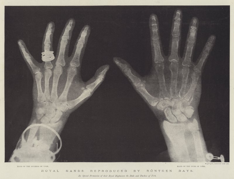 Royal Hands reprodukowana przez Rontgen Rays (grafika) autorstwa English School