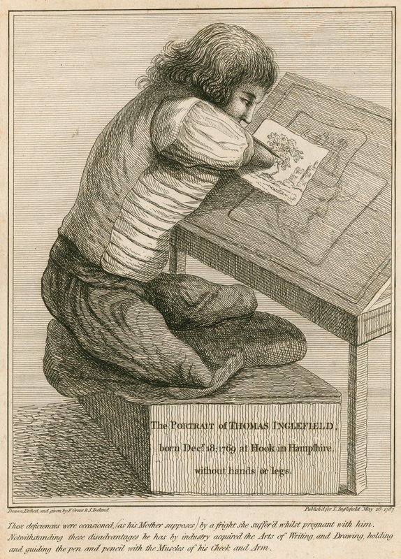 Thomas Inglefield, urodzony 18 grudnia 1769 w Hook, Hampshire, bez rąk i nóg autorstwa English School