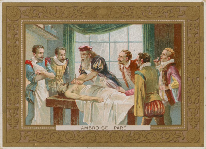 Ambroise Pare, XVI-wieczny francuski chirurg autorstwa French School