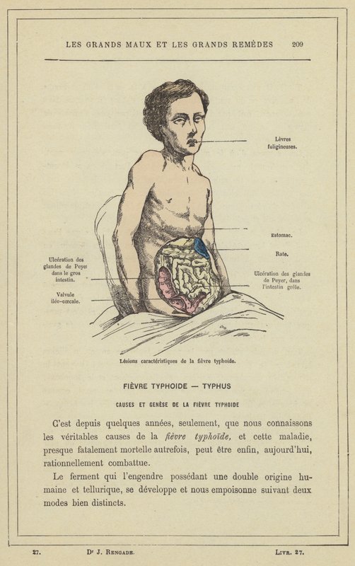 Charakterystyczne zmiany durowe (kolor lito) autorstwa French School
