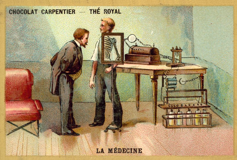 Pacjent po prześwietleniu (chromolitho) autorstwa French School