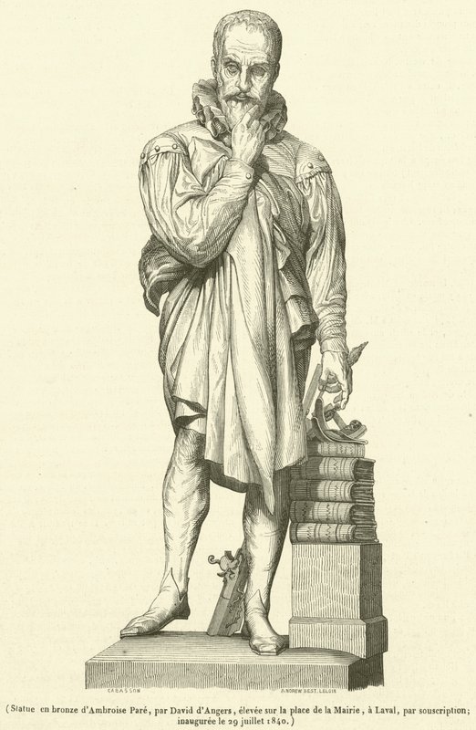 Spiżowa statua Ambroise Pare (rycina) autorstwa French School