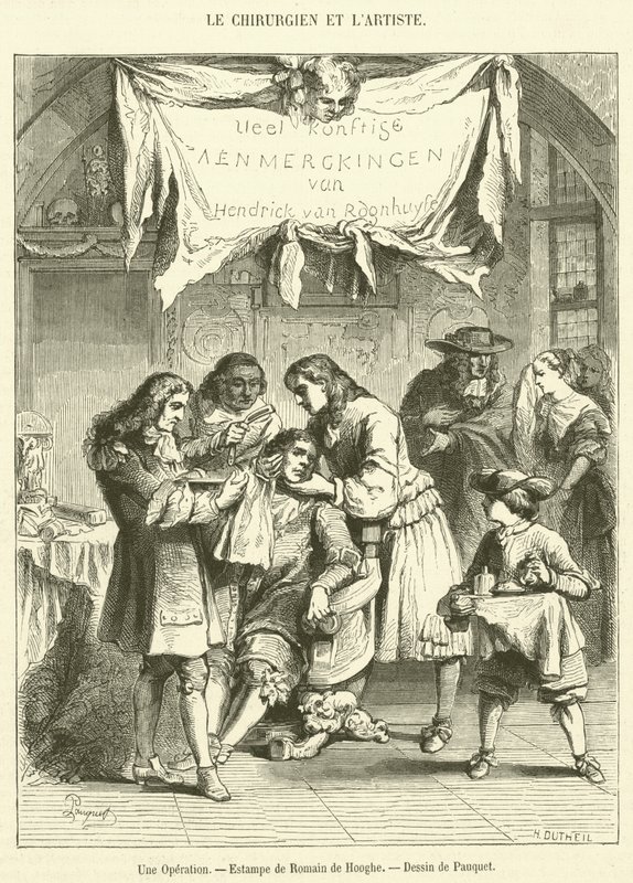 Operacja (grawerowanie) autorstwa French School