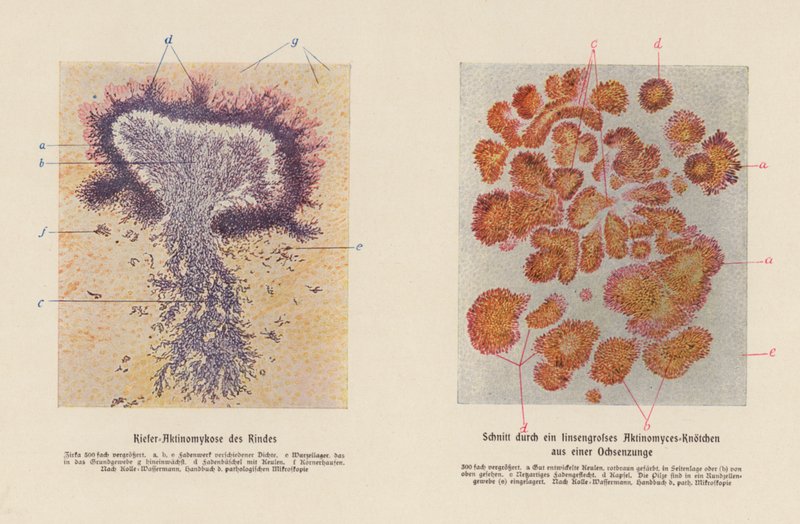 Actinomyces bovis (litografia kolorowa) autorstwa German School