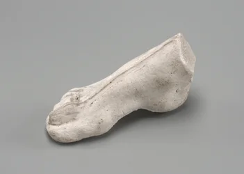 Prawa stopa, prawdopodobnie 1880.