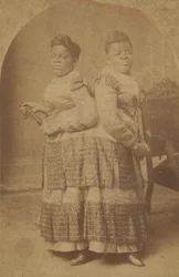 Odbitka albuminowa Millie i Christine McCoy, 1880-1890.