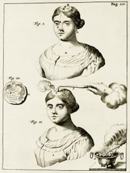 Leczenie chorego na padaczkę, z Ćwiczeń z praktyki lekarskiej Frederika Dekkersa, 1694