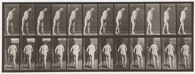 Tabliczka 547. Hemiplegia; Chodzenie z kulą, 1885