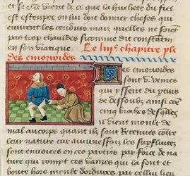 Ms 22532 Badanie pacjenta z hemoroidami, z Le Livre des Proprietes des Choses Barthelemy