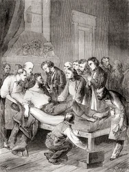 Pierwsza publiczna demonstracja użycia wziewnego eteru jako chirurgicznego środka znieczulającego w 1846 r. przez amerykańskiego dentystę Williama Thomasa Greena Mortona z „Les Merveilles de la Science”, opublikowana ok. 1870 r.