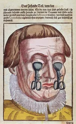 Leczenie choroby oka, z Ophthalmodouleia Georga Bartischa (1535-1636) wydanej w Dreźnie w 1583 r. (kolorowy drzeworyt)