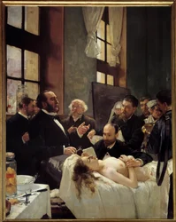 Dr Jules-Émile Péan (1830-1898) wykłada w szpitalu Saint-Louis o swoim odkryciu zaciskania naczyń. „Przed operacją”. Obraz Henri Gervexa (1852-1929), 1887. Wys. 2,42 x 1,88 m, Paryż, Musée d