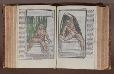 Anatomia kobiety, z komentarzy do anatomii świata z najwspanialszymi dodatkami, autorstwa Jacopo Berengario da Carpi (ok.1460-ok.1530) opublikowanych w Bolonii, 1521 (kolorowy drzeworyt)
