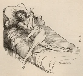 Epilepsja histeryczna, atak, wygięcia, ryc. 3 z „Iconographie Photographique de La Salpetriere” Bourneville et P. Regnard, Paryż, 1876