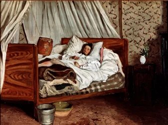 Improwizowana karetka (Claude Monet ranny). Obraz Jeana Frédérica Bazille