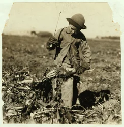 Alex Reiber w wieku 7 lat kontynuuje przycinanie buraków cukrowych po „zahaczeniu” kolana, niedaleko Sterling, Kolorado, 1915