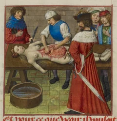 Harley 4425 f.59 Nero ogląda sekcję sekcji swojej matki Agrypiny, ilustracja z „Roman de la Rose” Jeana de Meun i Guillaume de Lorris c.1490-1500 (welum)